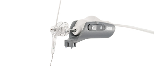 Bildbeschreibung: Auf dem Foto ist das robotergestützte Cochlea-Implantat-Einführsystem iotaSOFT zu sehen.